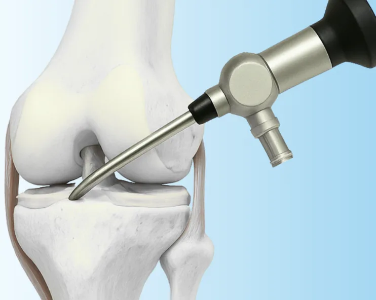 Knee